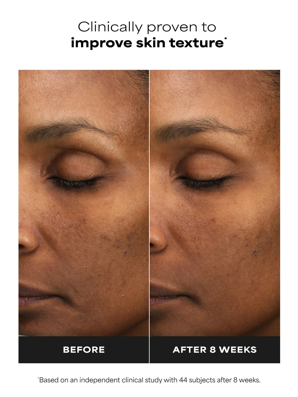 SKIN PERFECTING 6% Mandelic Acid + 2% Lactic Acid Liquid Exfoliant - Detail