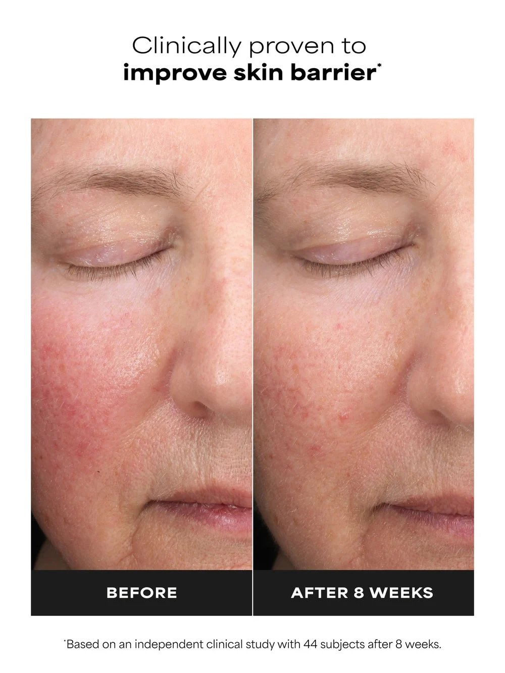 SKIN PERFECTING 6% Mandelic Acid + 2% Lactic Acid Liquid Exfoliant - Detail