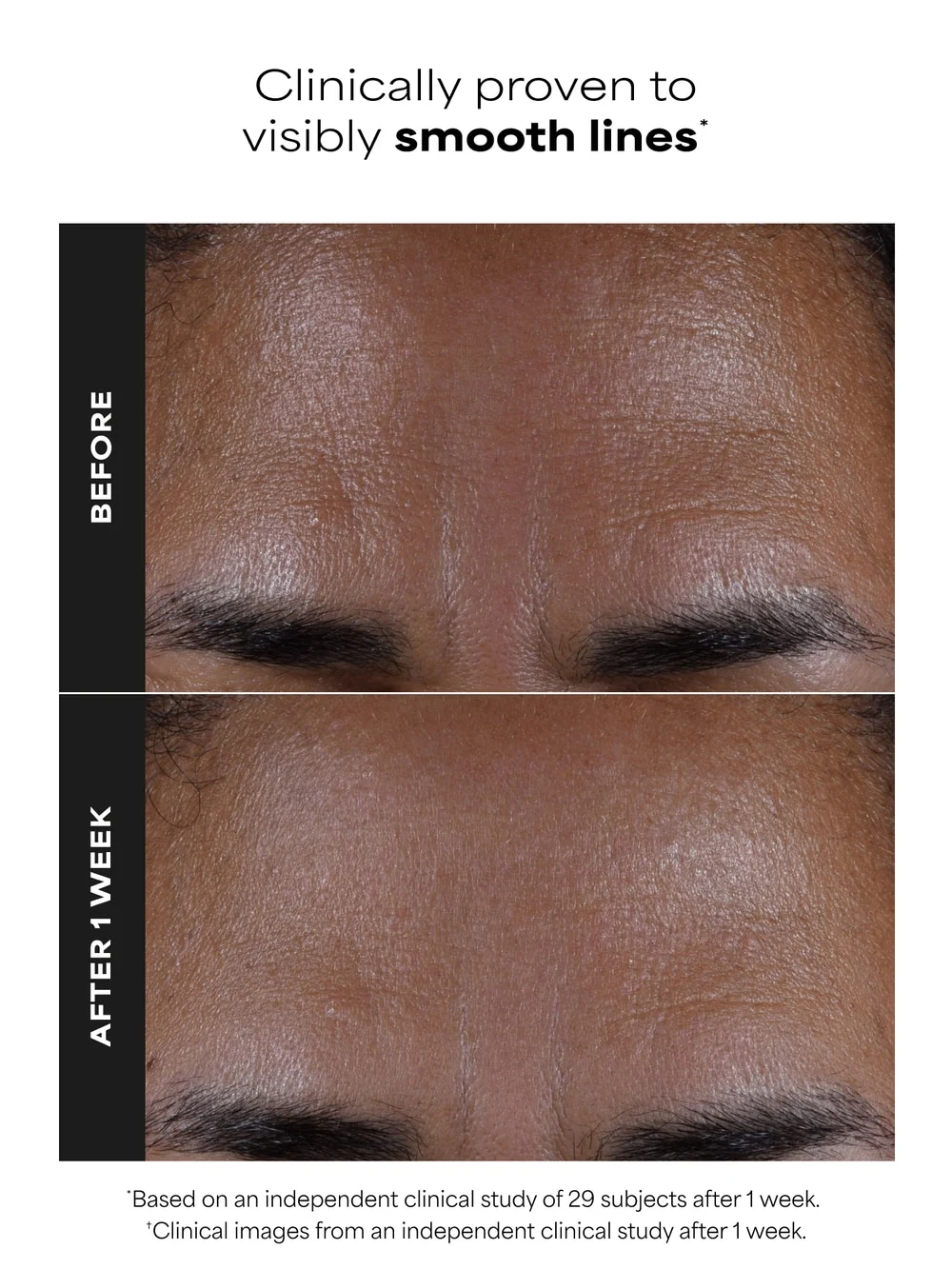 2% BHA Liquid Exfoliant - Detail
