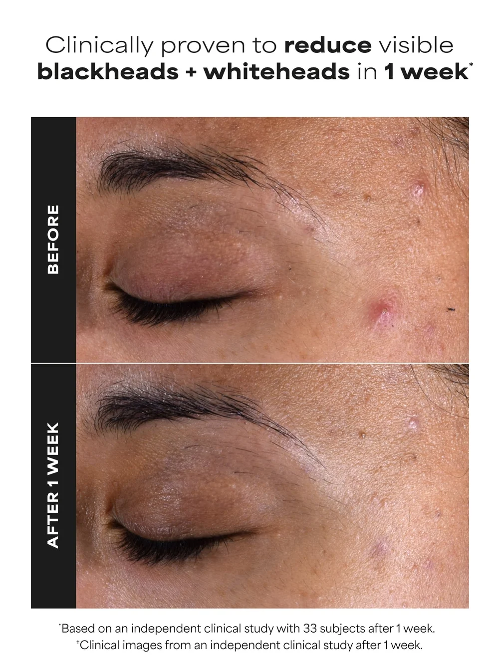 2% BHA Liquid Exfoliant - Detail