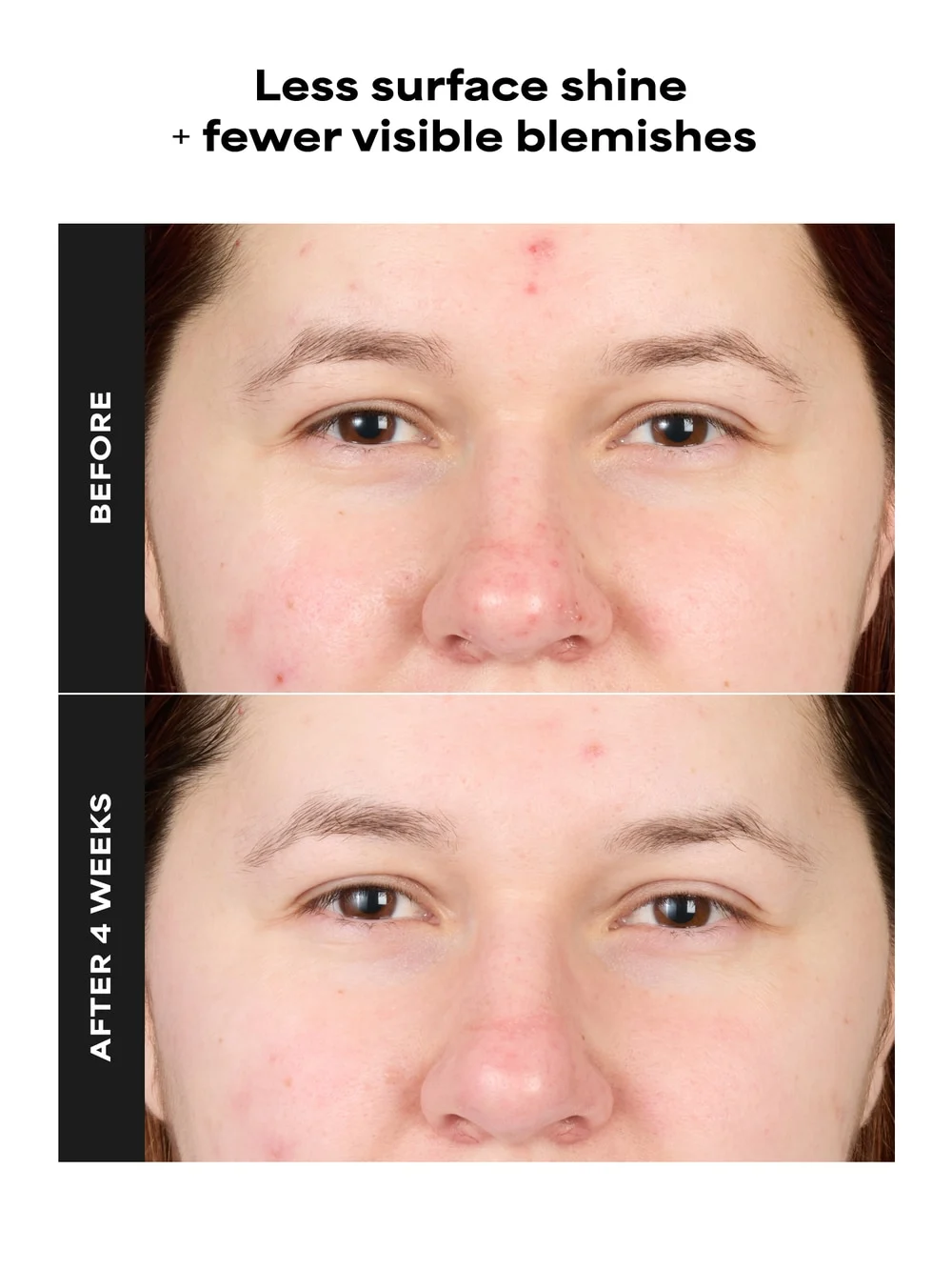 SKIN PERFECTING 4% BHA Advanced Exfoliating Serum Toner - Detail