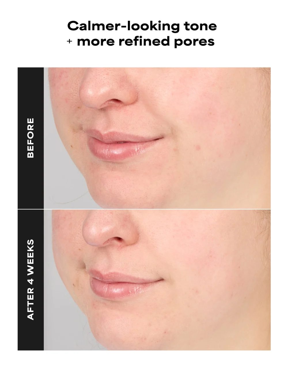 SKIN PERFECTING 4% BHA Advanced Exfoliating Serum Toner - Detail